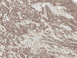 sFRP-2 Antibody, Novus Biologicals 100 &mu;g; Unconjugated:Antibodies,