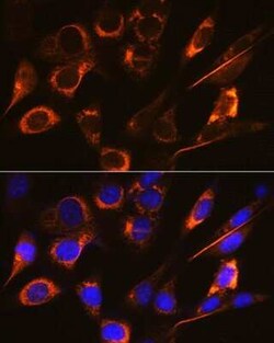 sFRP-4 Rabbit anti-Human, Mouse, Rat, Clone: 7Z6Q1, Novus Biologicals 20