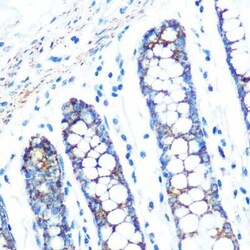sFRP-4 Rabbit anti-Human, Mouse, Rat, Clone: 7Z6Q1, Novus Biologicals 20