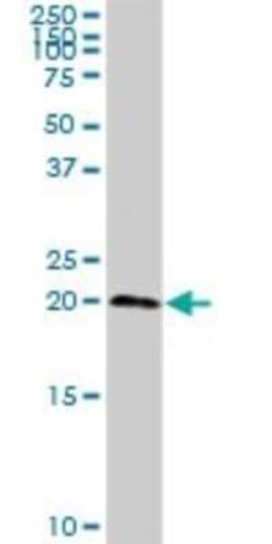 sen15 Antibody, Novus Biologicals 0.1 mg | Buy Online | Novus Biologicals | Fisher Scientific