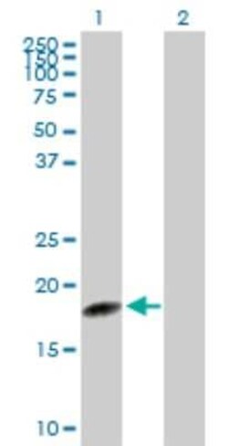sen15 Antibody, Novus Biologicals 0.1 mg | Buy Online | Novus Biologicals | Fisher Scientific