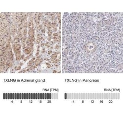 taxilin gamma Antibody, Novus Biologicals:Antibodies:Primary Antibodies