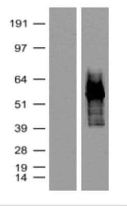 tdTomato Antibody (OTI2H2), Novus Biologicals 100 &mu;g, Unconjugated:Antibodies,