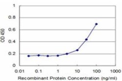 tropomyosin-2 Antibody (3C8), Novus Biologicals 0.1 mg | Buy Online | Novus Biologicals | Fisher Scientific