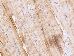 tropomyosin-2 Antibody, Novus Biologicals:Antibodies:Primary Antibodies