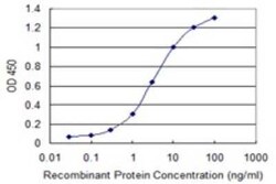 tropomyosin-3 Antibody (2E4), Novus Biologicals 0.1 mg | Buy Online | Novus Biologicals | Fisher Scientific