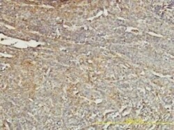 tropomyosin-4 Antibody (4E4-1D2), Novus Biologicals 0.1 mg | Buy Online | Novus Biologicals | Fisher Scientific