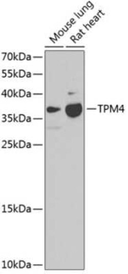 tropomyosin-4 Antibody - BSA Free, Novus Biologicals 0.1 mL; Unconjugated:Antibodies,