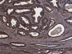 u-Plasminogen Activator/Urokinase Antibody, Novus Biologicals 0.1 mg; Unconjugated:Antibodies,