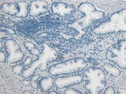 u-Plasminogen Activator/Urokinase Antibody, Novus Biologicals 0.1 mg; Unconjugated:Antibodies,