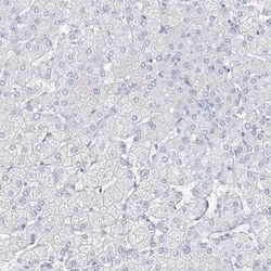 villin-like Antibody, Novus Biologicals 25 &mu;L | Buy Online | Novus Biologicals | Fisher Scientific