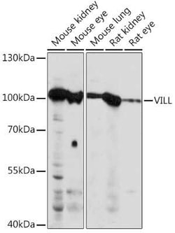 villin-like Antibody - Azide and BSA Free, Novus Biologicals:Antibodies:Primary