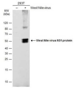 wnvNS1 Protein Antibody, Novus Biologicals 100 &mu;g | Buy Online | Novus Biologicals | Fisher Scientific