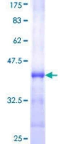 Novus Biologicals Recombinant Human 12-Lipoxygenase GST (N-Term) Protein 25 &mu;g | Buy Online | Novus Biologicals&trade; | Fisher Scientific