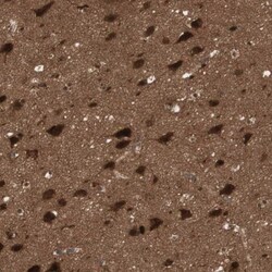 14-3-3 beta/alpha Antibody, Novus Biologicals 0.1mL; Unlabeled:Antibodies,