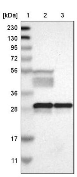 14-3-3 beta/alpha Antibody, Novus Biologicals 0.1mL; Unlabeled:Antibodies,