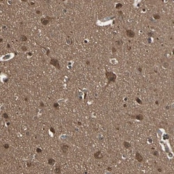 14-3-3 epsilon Antibody, Novus Biologicals:Antibodies:Primary Antibodies