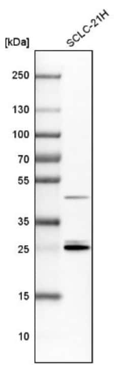 14-3-3 epsilon Antibody, Novus Biologicals:Antibodies:Primary Antibodies