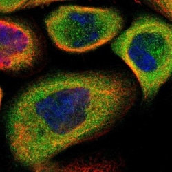 14-3-3 sigma/Stratifin Antibody, Novus Biologicals 25 &mu;L; Unlabeled:Antibodies,