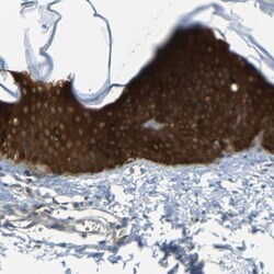14-3-3 sigma/Stratifin Antibody, Novus Biologicals 25 &mu;L; Unlabeled:Antibodies,