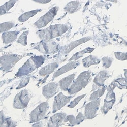 14-3-3 sigma/Stratifin Antibody, Novus Biologicals 25 &mu;L; Unlabeled:Antibodies,