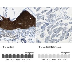 14-3-3 sigma/Stratifin Antibody, Novus Biologicals 25 &mu;L; Unlabeled:Antibodies,