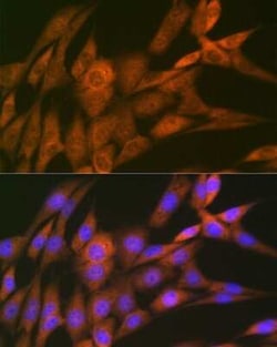 14-3-3 tau/theta Rabbit anti-Human, Mouse, Rat, Clone: 9G6M4, Novus Biologicals 100 &mu;g | Buy Online | Novus Biologicals | Fisher Scientific