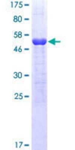 Novus Biologicals Recombinant Human 14-3-3 zeta/delta GST (N-Term) Protein 10 &mu;g | Buy Online | Novus Biologicals&trade; | Fisher Scientific