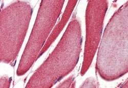 15-Lipoxygenase 1 Antibody, Novus Biologicals 0.1mg; Unlabeled:Antibodies,