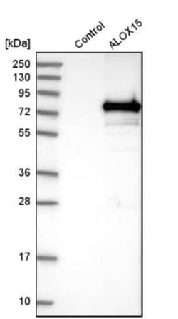 15-Lipoxygenase 1 Antibody, Novus Biologicals 25 &mu;L; Unlabeled:Antibodies,