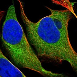 17 beta-HSD1/HSD17B1 Antibody, Novus Biologicals 0.1mL; Unlabeled:Antibodies,