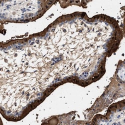 17 beta-HSD1/HSD17B1 Antibody, Novus Biologicals 0.1mL; Unlabeled:Antibodies,