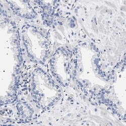 17 beta-HSD1/HSD17B1 Antibody, Novus Biologicals 0.1mL; Unlabeled:Antibodies,