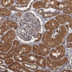 26S proteasome subunit 9 Antibody, Novus Biologicals 0.1mL; Unlabeled:Antibodies,