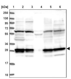 26S proteasome subunit 9 Antibody, Novus Biologicals 0.1mL; Unlabeled:Antibodies,