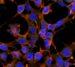 4-Hydroxynonenal Antibody (12F7), Novus Biologicals 100&mu;g; Unlabeled:Antibodies,