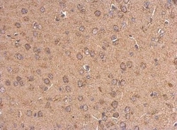 5-HT1A Antibody, Novus Biologicals 0.1mL; Unlabeled:Antibodies, Polyclonal