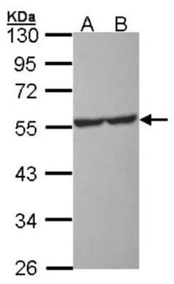 5-HT1A Antibody, Novus Biologicals 0.1mL; Unlabeled:Antibodies, Polyclonal