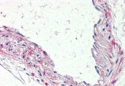 5-HT1B Antibody - BSA Free, Novus Biologicals 50 &mu;g | Buy Online | Novus Biologicals | Fisher Scientific