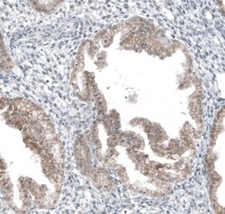 5-HT1E Antibody, Novus Biologicals 25 &mu;L; Unlabeled:Antibodies, Polyclonal