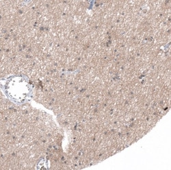 5-HT1E Antibody, Novus Biologicals 25 &mu;L; Unlabeled:Antibodies, Polyclonal