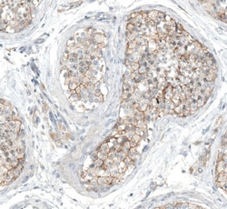 5-HT1E Antibody, Novus Biologicals 25 &mu;L; Unlabeled:Antibodies, Polyclonal
