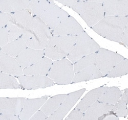 5-HT1E Antibody, Novus Biologicals 25 &mu;L; Unlabeled:Antibodies, Polyclonal