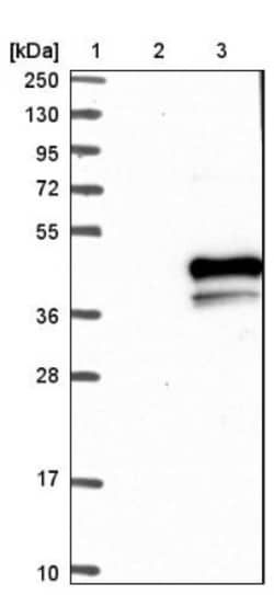 5-HT1E Antibody, Novus Biologicals 25 &mu;L; Unlabeled:Antibodies, Polyclonal