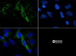 5-HT4 Antibody - BSA Free, Novus Biologicals 0.1mL; Unlabeled:Antibodies,