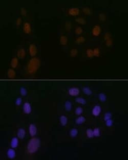 5-Lipoxygenase Rabbit anti-Human, Mouse, Rat, Clone: 5C5Z2, Novus Biologicals