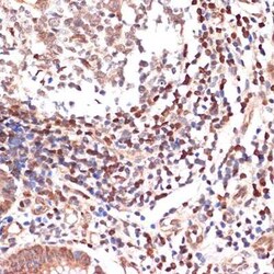 5-Lipoxygenase Rabbit anti-Human, Mouse, Rat, Clone: 5C5Z2, Novus Biologicals