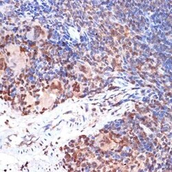 5-Lipoxygenase Rabbit anti-Human, Mouse, Rat, Clone: 5C5Z2, Novus Biologicals