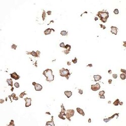 5'-Nucleotidase/CD73 Antibody (BLR054F), Novus Biologicals 100 &mu;g | Buy Online | Novus Biologicals | Fisher Scientific