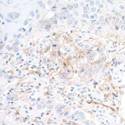 5'-Nucleotidase/CD73 Antibody (BLR054F), Novus Biologicals 100 &mu;g | Buy Online | Novus Biologicals | Fisher Scientific